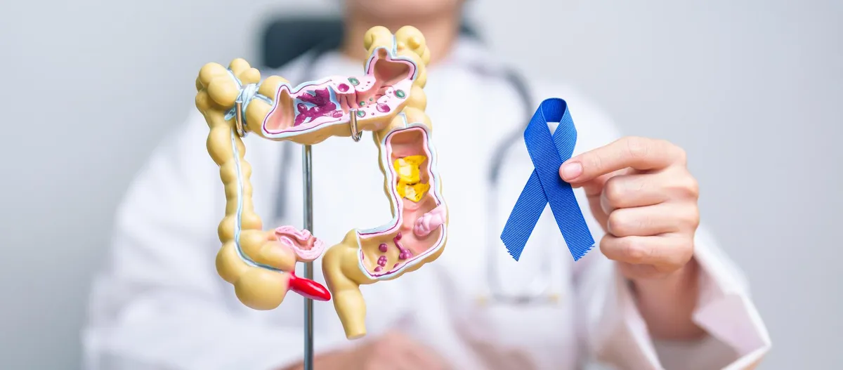 Medic prezentând un model anatomic al colonului